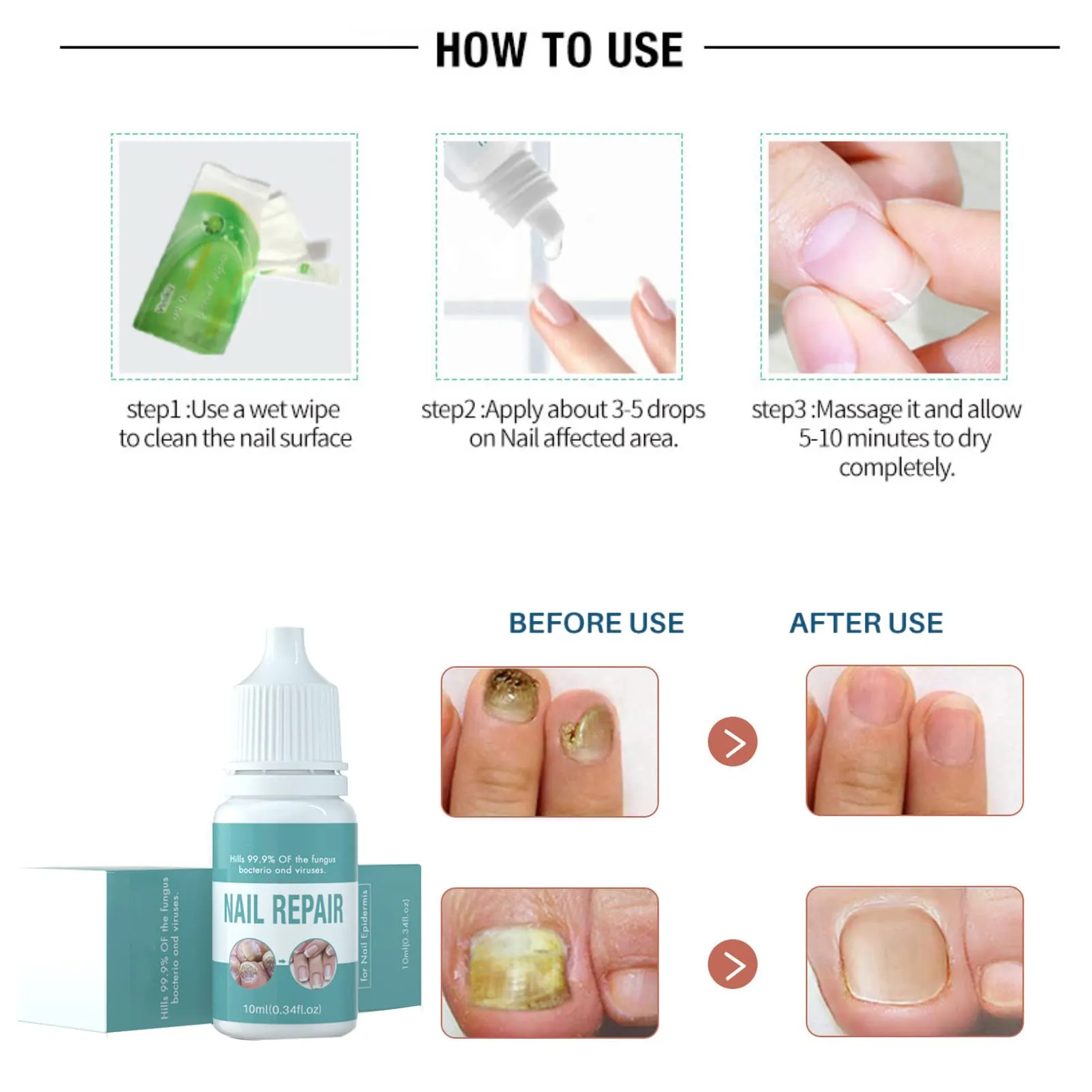 Antifungal Nail Repair,Fungus Treatment Fungal Nail Care,Nail Treatment,Nail Care Solution to Repair Damaged,Cracked and Discolored Nails