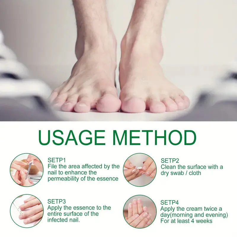 Ginger Nail Care Liquid Onychomycosis Fungus Repair Hand and Foot Nail Care