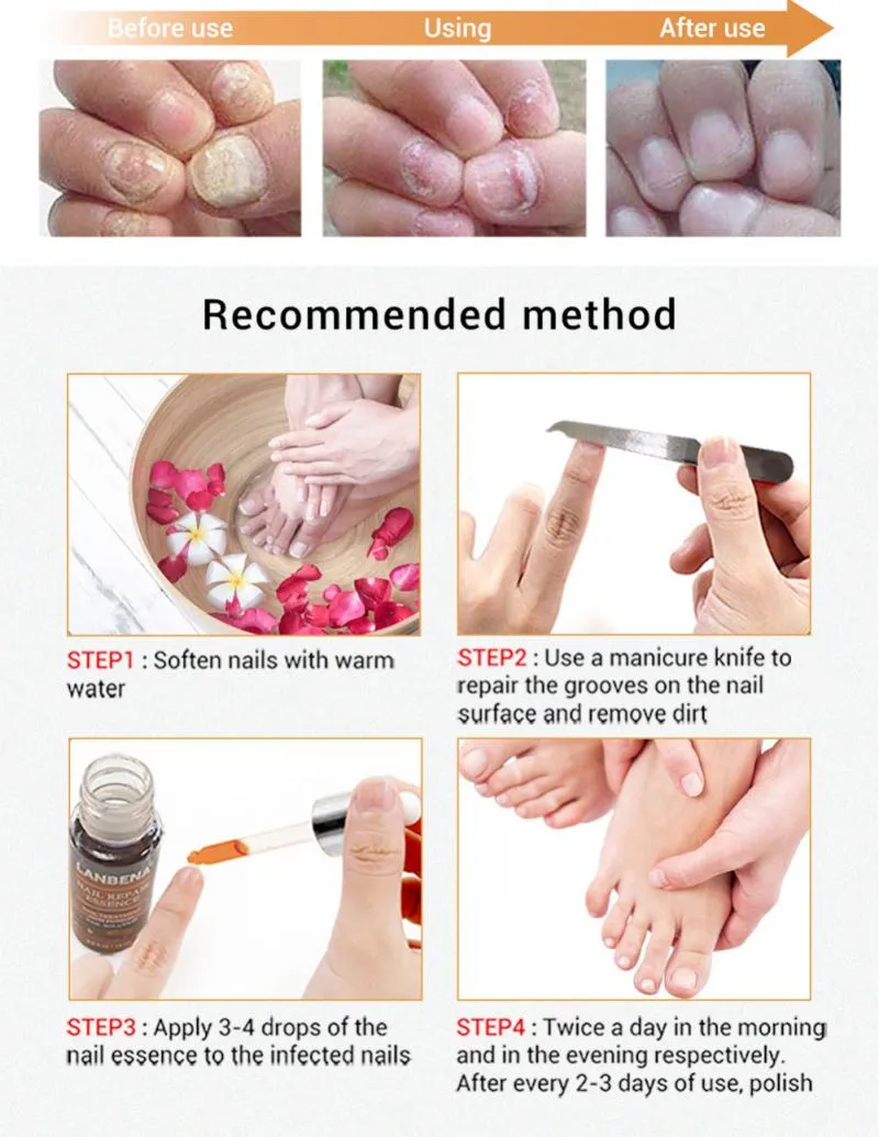 LANBENA Nail Fungus Treatment Anti Fungal ...