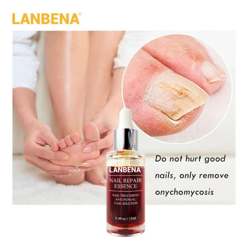 LANBENA Nail Fungus Treatment Anti Fungal ...