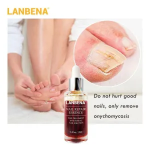 LANBENA Nail Fungus Treatment Anti Fungal ...
